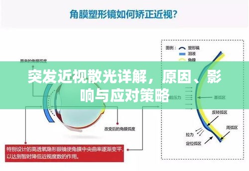 突發(fā)近視散光詳解，原因、影響與應(yīng)對(duì)策略