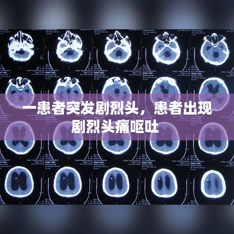 一患者突發(fā)劇烈頭，患者出現(xiàn)劇烈頭痛嘔吐 