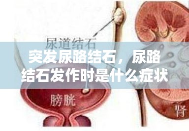 突發(fā)尿路結(jié)石，尿路結(jié)石發(fā)作時是什么癥狀? 