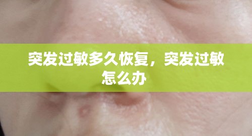 突發(fā)過敏多久恢復(fù)，突發(fā)過敏怎么辦 
