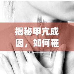 揭秘甲亢成因，如何罹患甲狀腺功能亢進(jìn)？