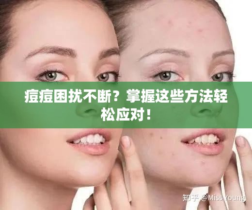 痘痘困擾不斷？掌握這些方法輕松應(yīng)對(duì)！