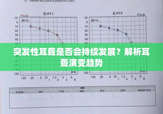 突發(fā)性耳聾是否會持續(xù)發(fā)展？解析耳聾演變趨勢