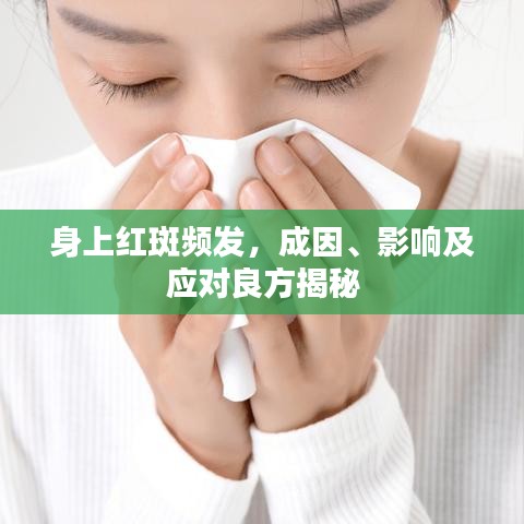 身上紅斑頻發(fā)，成因、影響及應(yīng)對良方揭秘