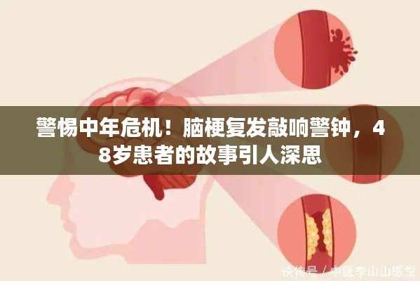 警惕中年危機(jī)！腦梗復(fù)發(fā)敲響警鐘，48歲患者的故事引人深思